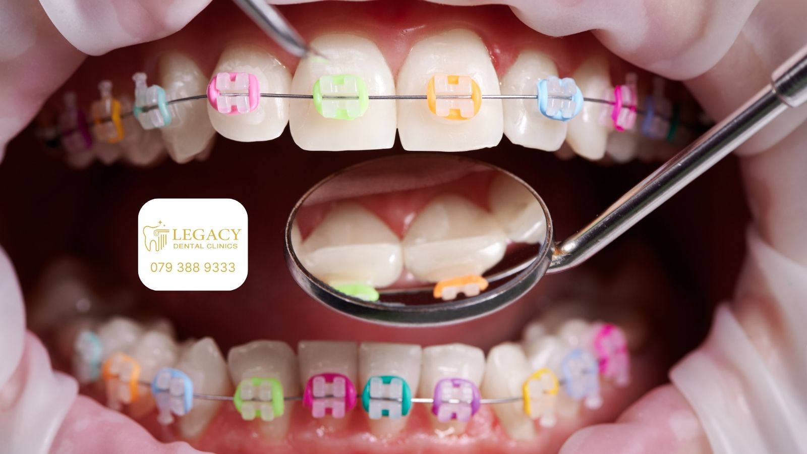 أفضل دكتور تقويم أسنان في عمان، الأردن
