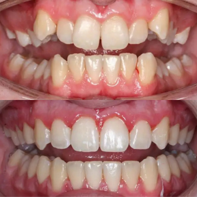 تقويم انفزلاين قبل وبعد في الأردن