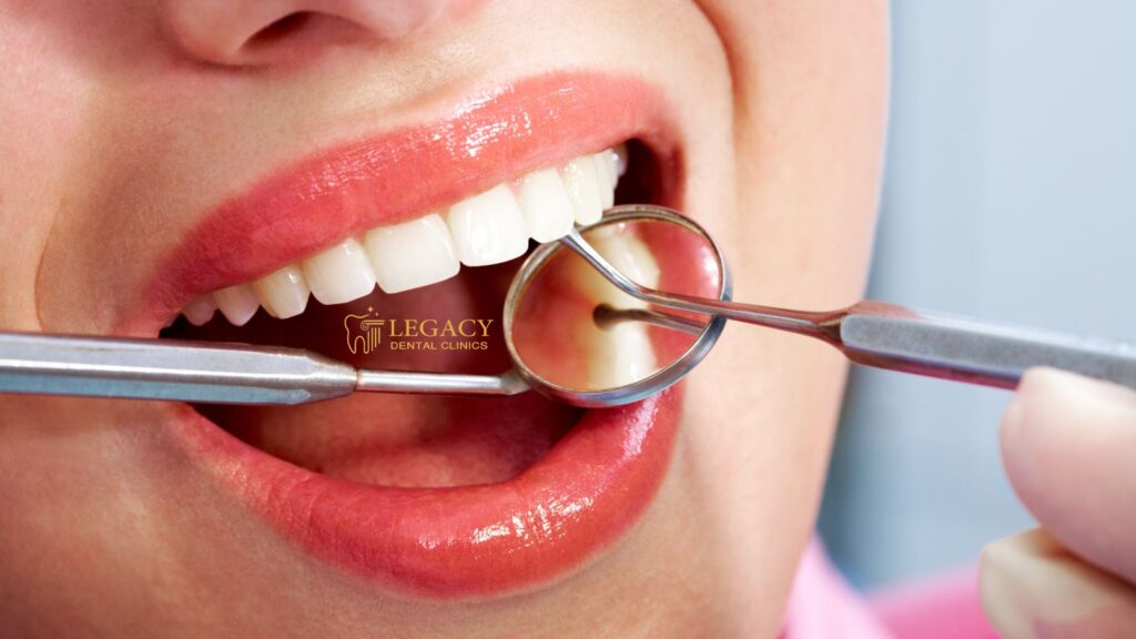 Dental Cleaning Cost in Amman, Jordan