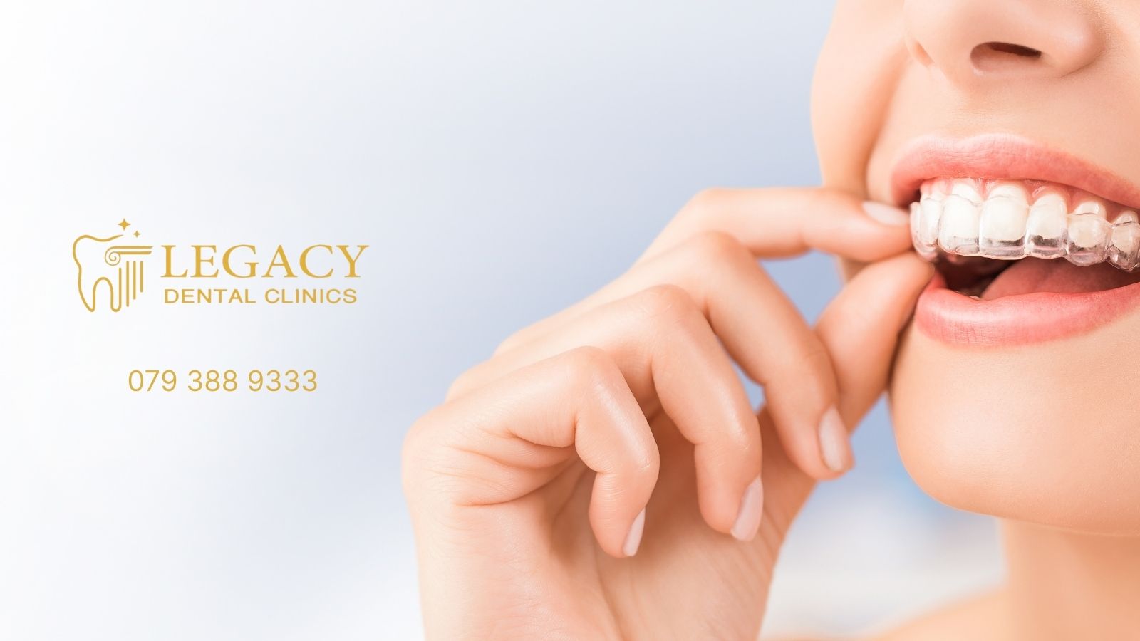 Invisalign Dentist in Amman, Jordan