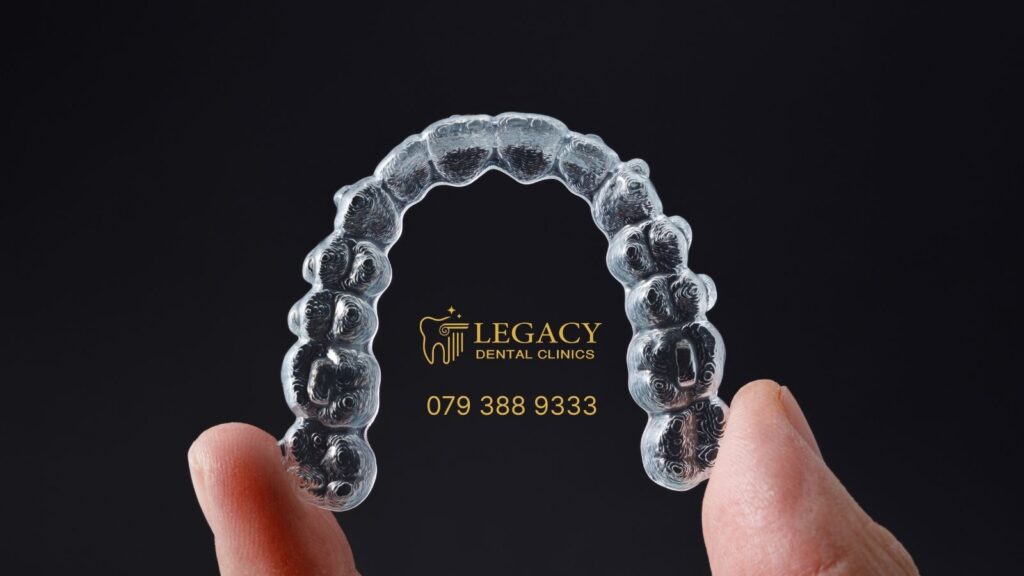 Is there Invisalign in Jordan?