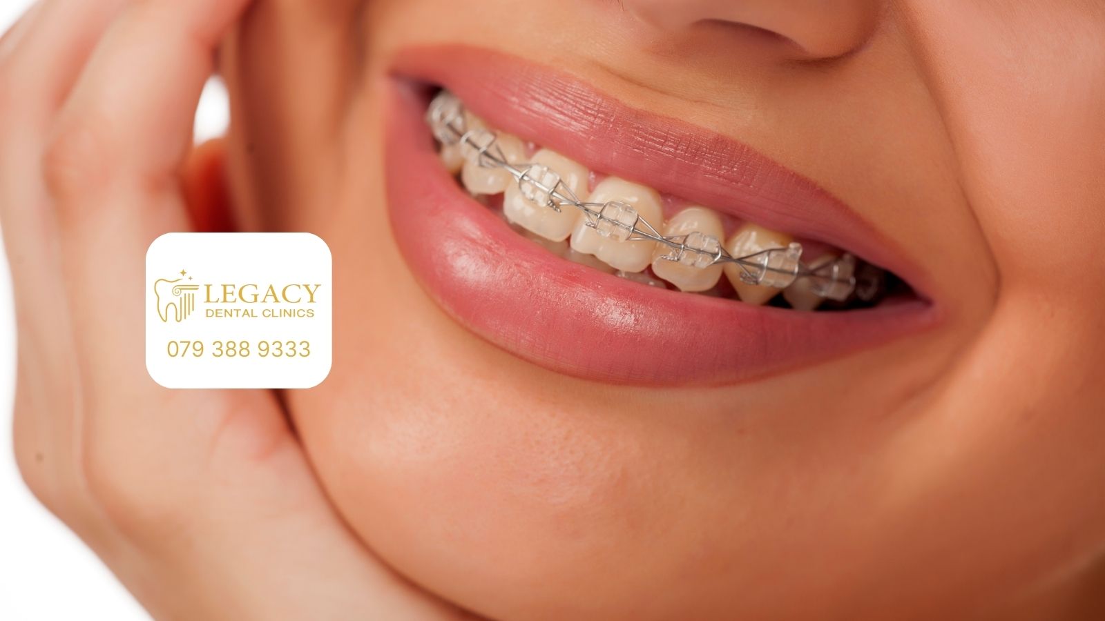orthodontist amman jordan