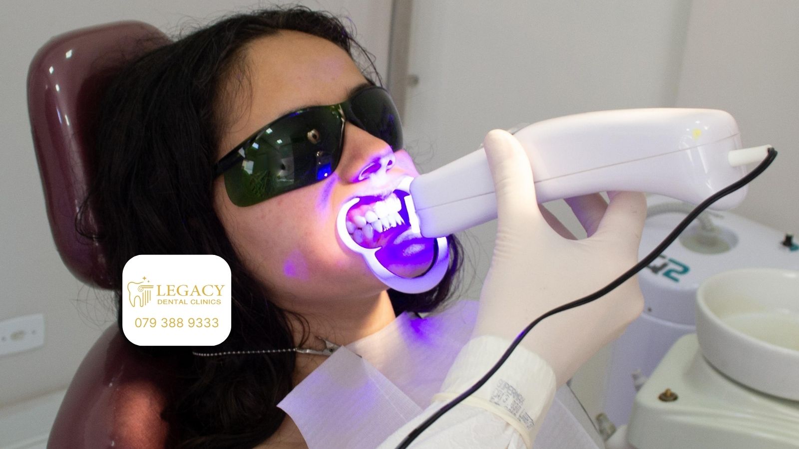 Laser Teeth Whitening in Amman, Jordan