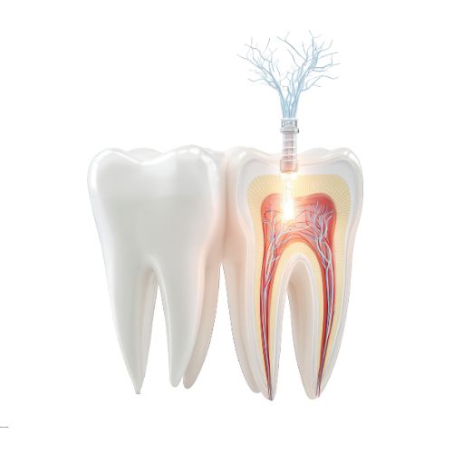 root canal treatment amman jordan