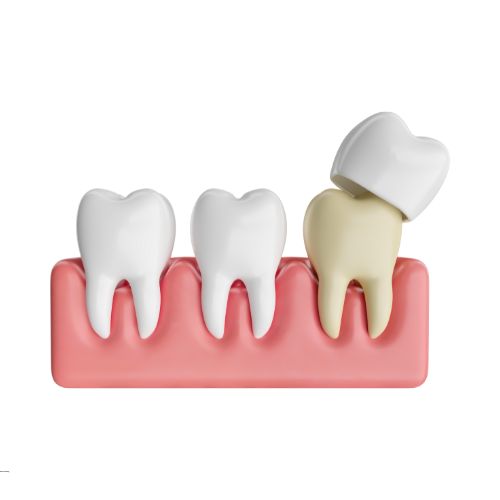 dental crown amman jordan, dental crown near me