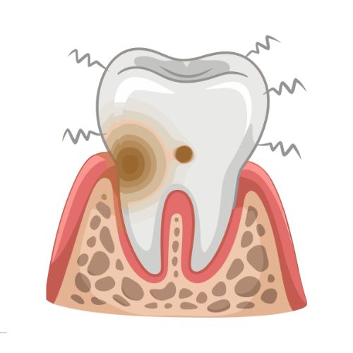 emergency dental treatment, 24 hour dental treatment, emergency dental care, emergency dentist amman, emergency dentist near me