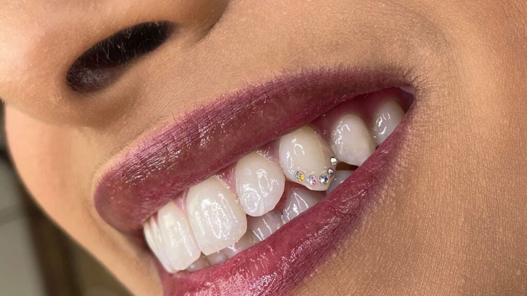 How much do tooth gems cost in Amman, Jordan?