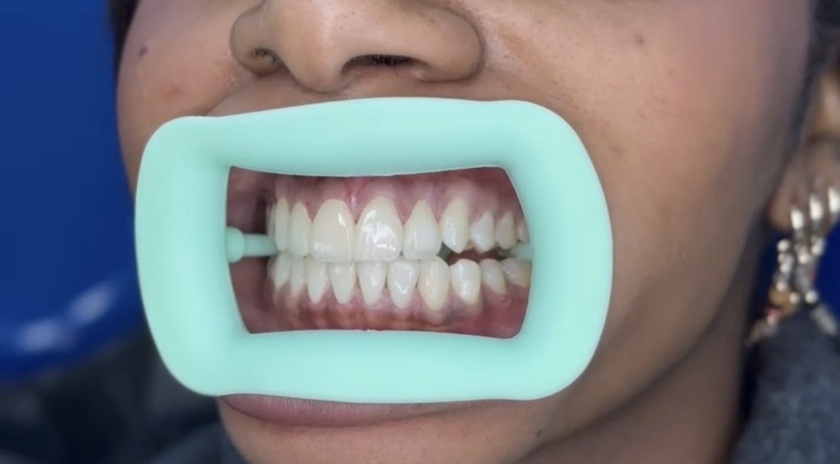 Cosmetic Dentist in Amman, Jordan