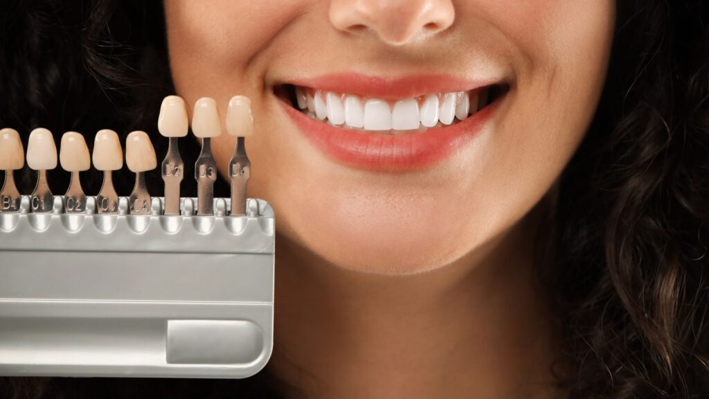 Best 10 Teeth Whitening Clinics Near You in Amman