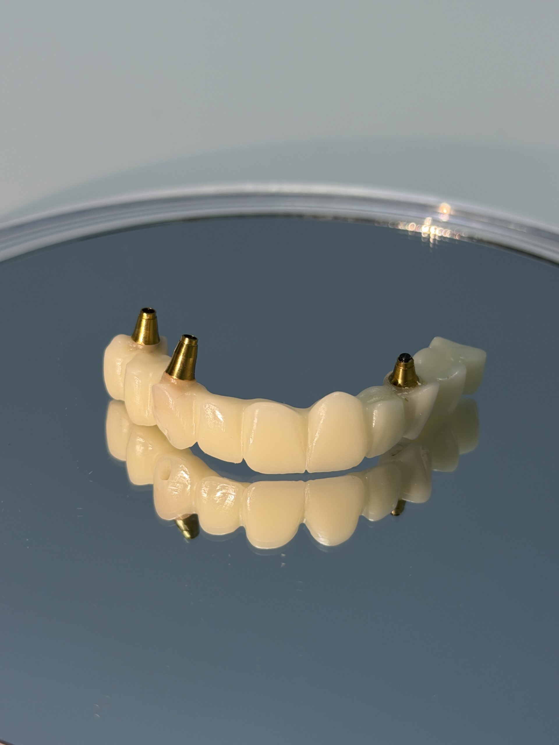 Temporary PMMA Bridge on 3 Implants