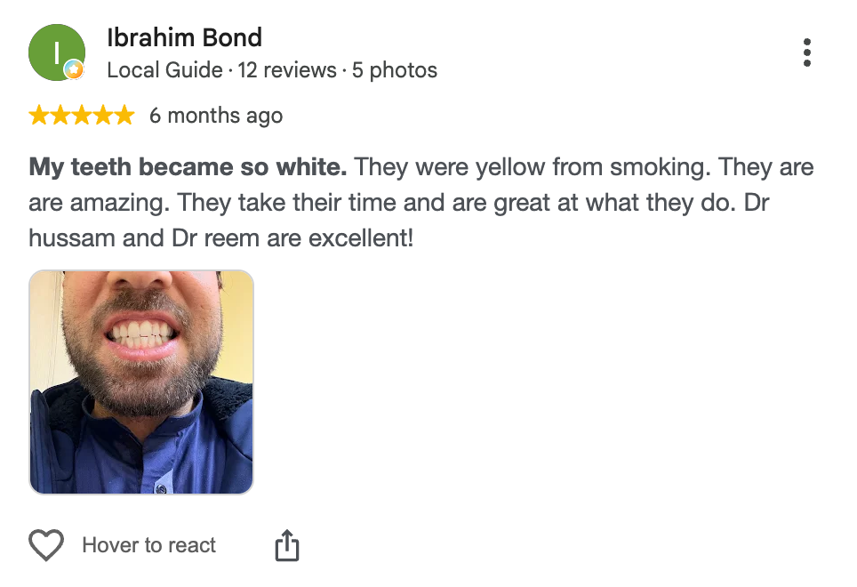 Teeth Whitening Amman Reviews: What Patients Say About Legacy Dental Clinics